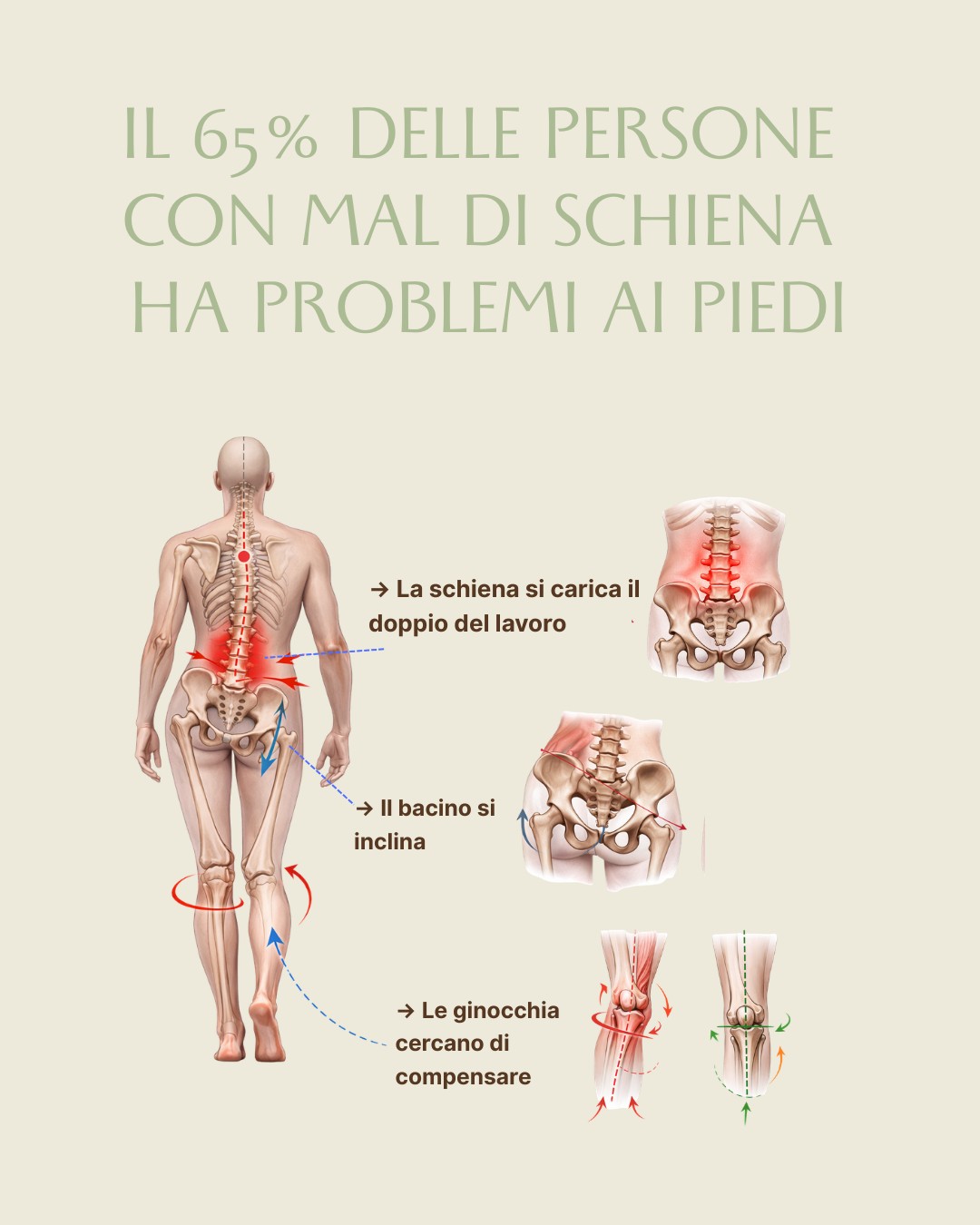 65% mal di schiena